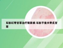 石斛红枣甘草治疗银屑病 石斛干姜大枣炙甘草