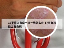 17岁脸上有白一块一块怎么办 17岁女孩脸上有白斑