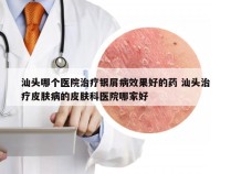 汕头哪个医院治疗银屑病效果好的药 汕头治疗皮肤病的皮肤科医院哪家好