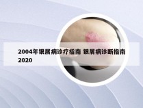 2004年银屑病诊疗指南 银屑病诊断指南2020