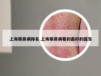 上海银屑病排名 上海银屑病看的最好的医生