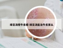 绿豆汤擦牛皮癣 绿豆汤能治牛皮屑么