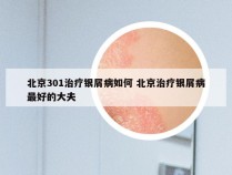 北京301治疗银屑病如何 北京治疗银屑病最好的大夫