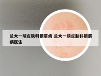 兰大一院皮肤科银屑病 兰大一院皮肤科银屑病医生