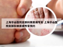上海华山医院皮肤科银屑病专家 上海华山医院皮肤科银屑病专家预约