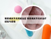 银屑病关节炎彻底治愈 银屑病关节炎的治疗经验与感悟