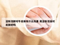 淀粉泡脚对牛皮癣有什么效果 用淀粉泡澡对皮肤好吗