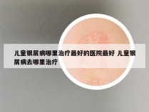 儿童银屑病哪里治疗最好的医院最好 儿童银屑病去哪里治疗