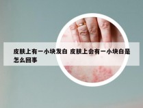 皮肤上有一小块发白 皮肤上会有一小块白是怎么回事