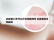 皮肤病23岁可以打生物制剂吗 皮肤病用生物制剂