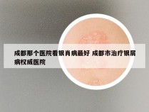 成都那个医院看银肖病最好 成都市治疗银屑病权威医院