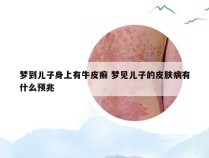 梦到儿子身上有牛皮癣 梦见儿子的皮肤病有什么预兆