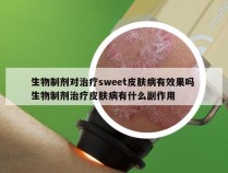 生物制剂对治疗sweet皮肤病有效果吗 生物制剂治疗皮肤病有什么副作用