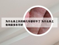 为什么身上长的癣几年都好不了 为什么身上有块藓多年不好