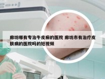 廊坊哪有专治牛皮癣的医院 廊坊市有治疗皮肤病的医院吗的短视频