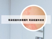 耳朵后面长皮屑图片 耳朵后面长皮皮