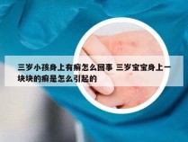 三岁小孩身上有癣怎么回事 三岁宝宝身上一块块的癣是怎么引起的