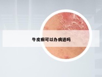 牛皮癣可以办病退吗