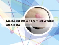 小孩得点滴状银屑病怎么治疗 儿童点滴状银屑病不易复发