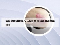 洛阳银屑病医院心丶杨淑莲 洛阳银屑病医院排名