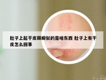 肚子上起干皮跟癣似的是啥东西 肚子上有干皮怎么回事