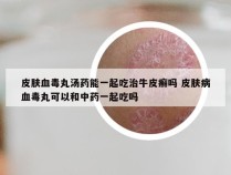 皮肤血毒丸汤药能一起吃治牛皮癣吗 皮肤病血毒丸可以和中药一起吃吗