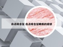 白点综合征 白点综合征眼疾的症状