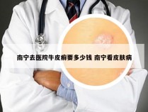 南宁去医院牛皮癣要多少钱 南宁看皮肤病
