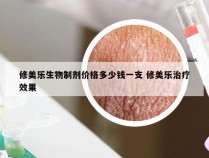 修美乐生物制剂价格多少钱一支 修美乐治疗效果