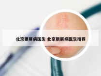 北京银屑病医生 北京银屑病医生推荐