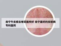 南宁牛皮癣去哪家医院好 南宁最好的皮肤病专科医院