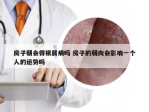 房子朝会得银屑病吗 房子的朝向会影响一个人的运势吗