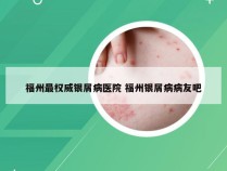 福州最权威银屑病医院 福州银屑病病友吧