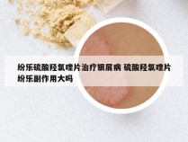 纷乐硫酸羟氯喹片治疗银屑病 硫酸羟氯喹片纷乐副作用大吗