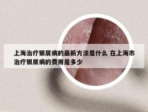 上海治疗银屑病的最新方法是什么 在上海市治疗银屑病的费用是多少