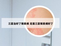 三亚治好了银屑病 定居三亚银屑病好了