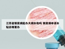 江苏省银屑病能办大病补助吗 银屑病申请补贴去哪里办