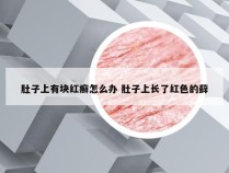 肚子上有块红癣怎么办 肚子上长了红色的藓