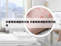长春银屑病医院介绍 长春银屑病医院预约挂号
