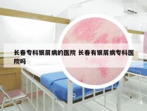 长春专科银屑病的医院 长春有银屑病专科医院吗