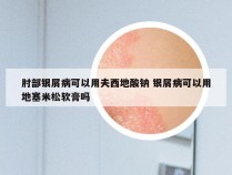 肘部银屑病可以用夫西地酸钠 银屑病可以用地塞米松软膏吗