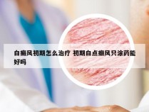 白癜风初期怎么治疗 初期白点癫风只涂药能好吗