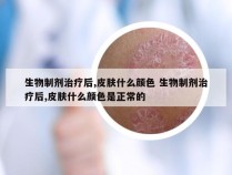 生物制剂治疗后,皮肤什么颜色 生物制剂治疗后,皮肤什么颜色是正常的