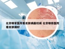 北京哪家医院看皮肤病最权威 北京哪些医院看皮肤病好