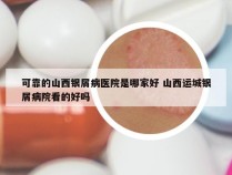 可靠的山西银屑病医院是哪家好 山西运城银屑病院看的好吗