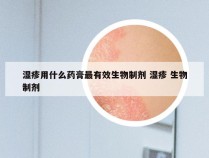 湿疹用什么药膏最有效生物制剂 湿疹 生物制剂