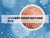cerave面霜牛皮癣刺痛 面部牛皮肤癣擦什么