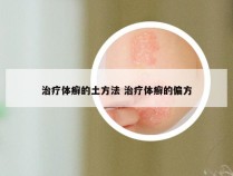 治疗体癣的土方法 治疗体癣的偏方