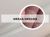 白斑怎么去 白斑怎么恢复