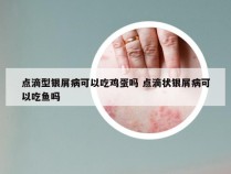 点滴型银屑病可以吃鸡蛋吗 点滴状银屑病可以吃鱼吗